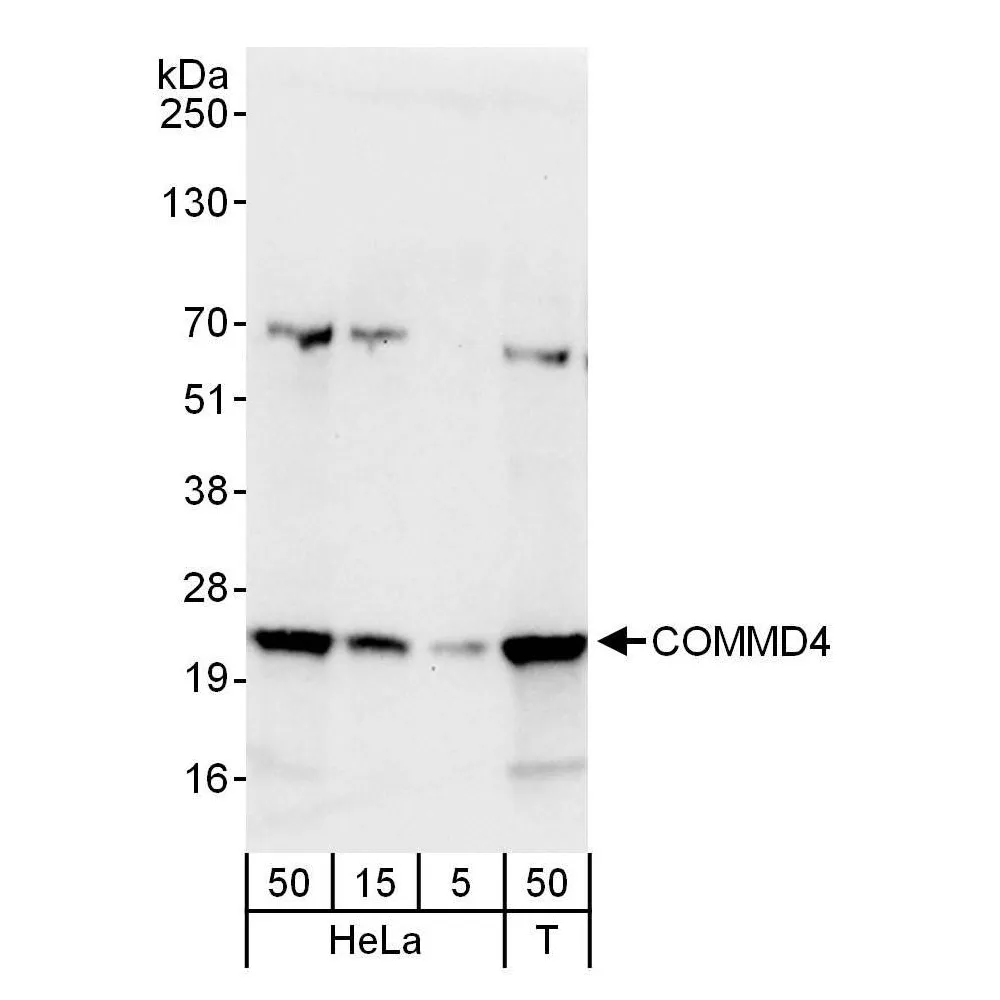 Rabbit anti-COMMD4 Antibody, Affinity Purified