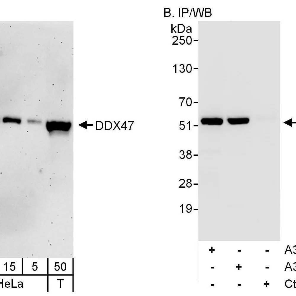 Rabbit anti-DDX47 Antibody, Affinity Purified