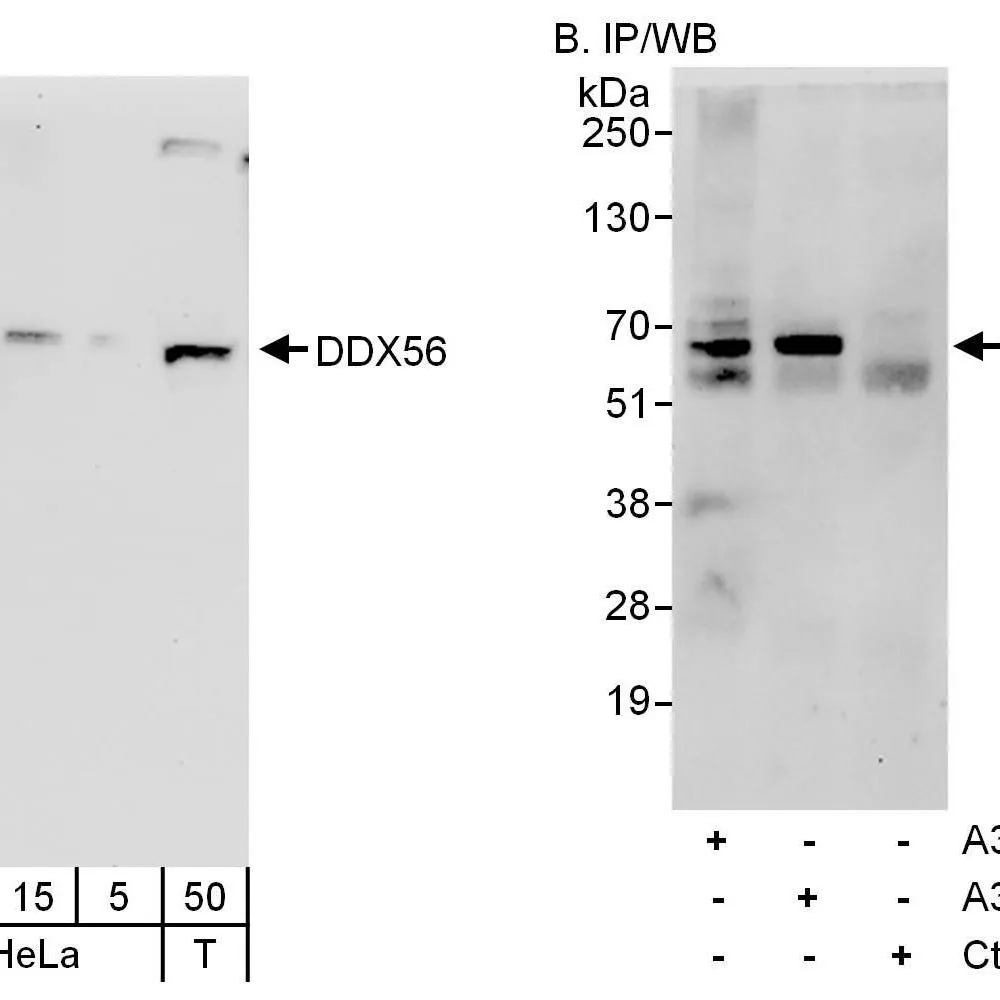 Rabbit anti-DDX56 Antibody, Affinity Purified