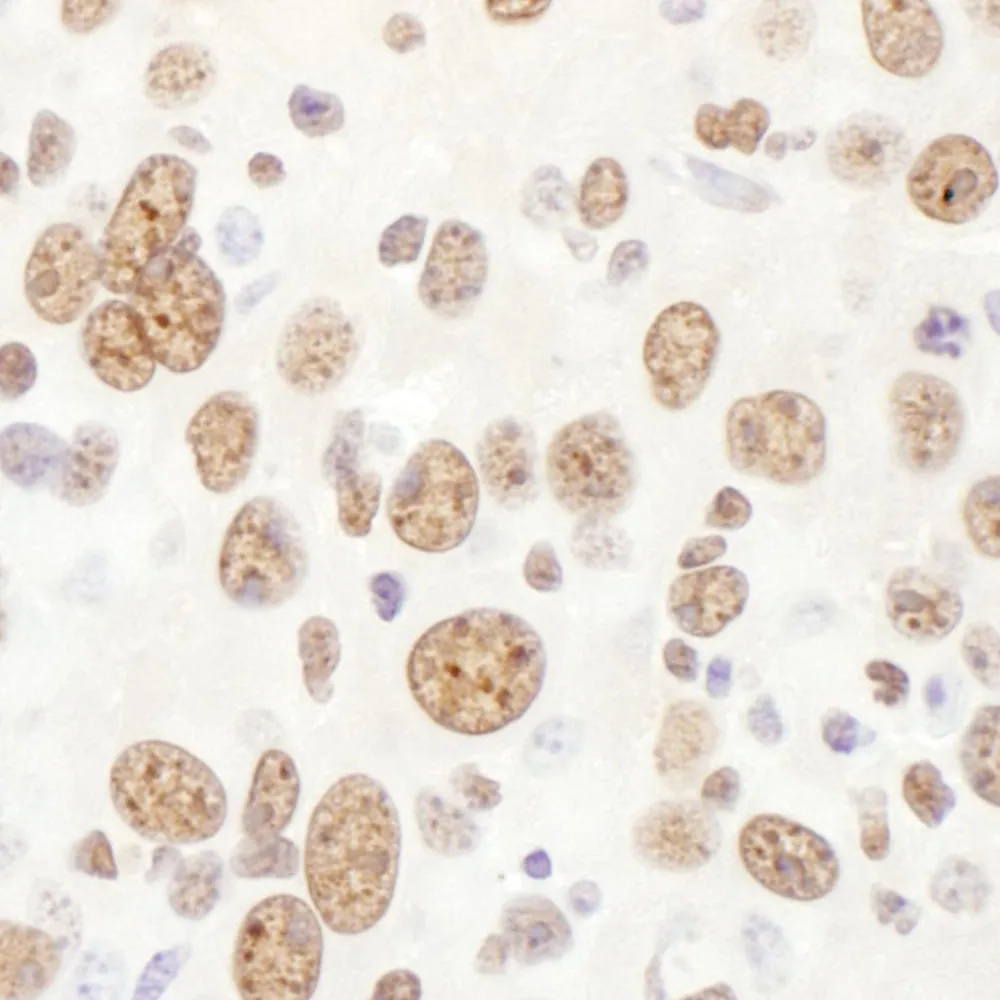 Rabbit anti-eIF4AIII/EIF4A3 Antibody, Affinity Purified