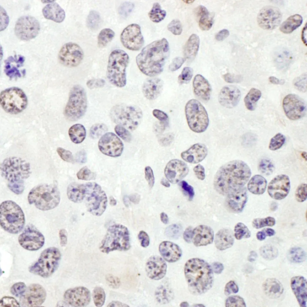 Rabbit anti-eIF4AIII/EIF4A3 Antibody, Affinity Purified