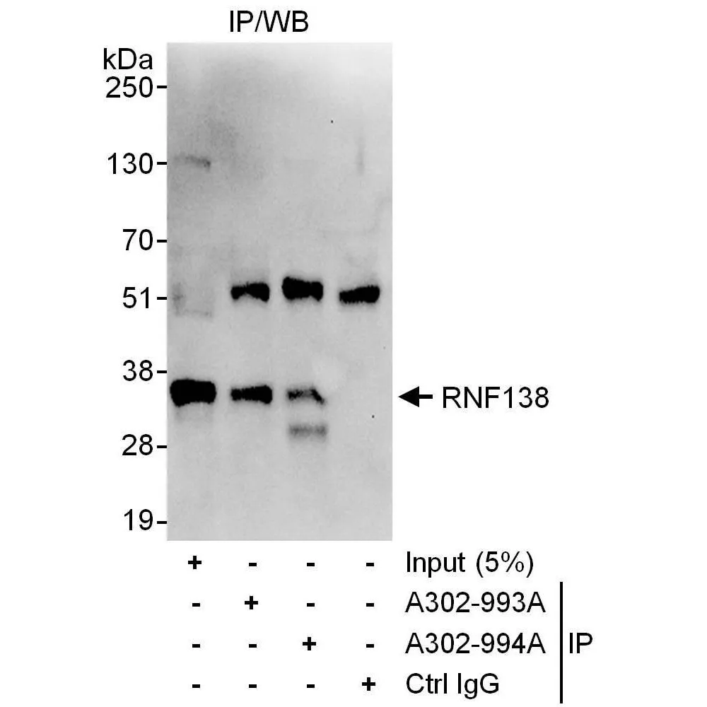 Rabbit anti-RNF138 Antibody, Affinity Purified