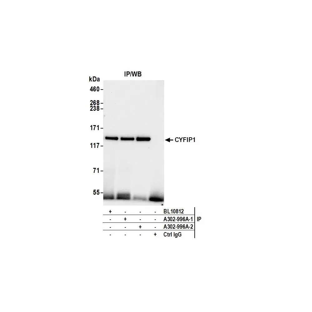 Rabbit anti-CYFIP1 Antibody, Affinity Purified