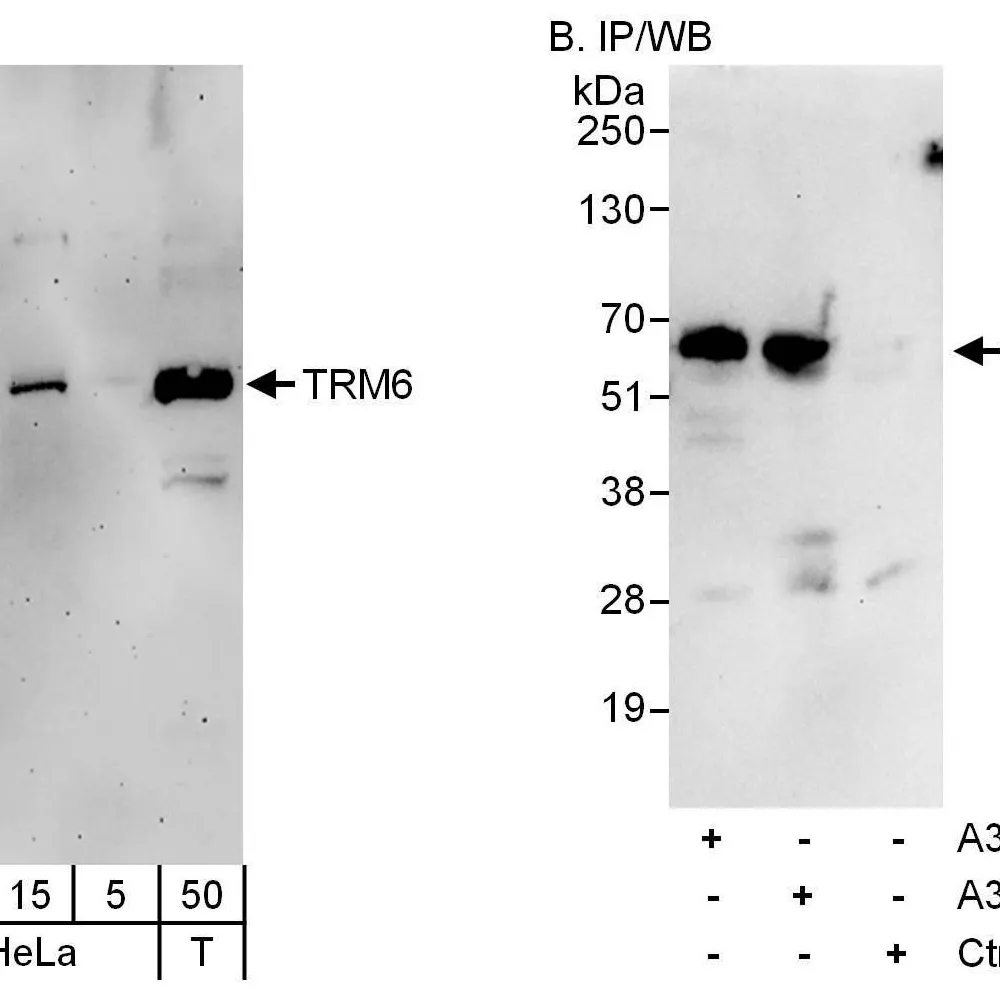 Rabbit anti-TRM6 Antibody, Affinity Purified