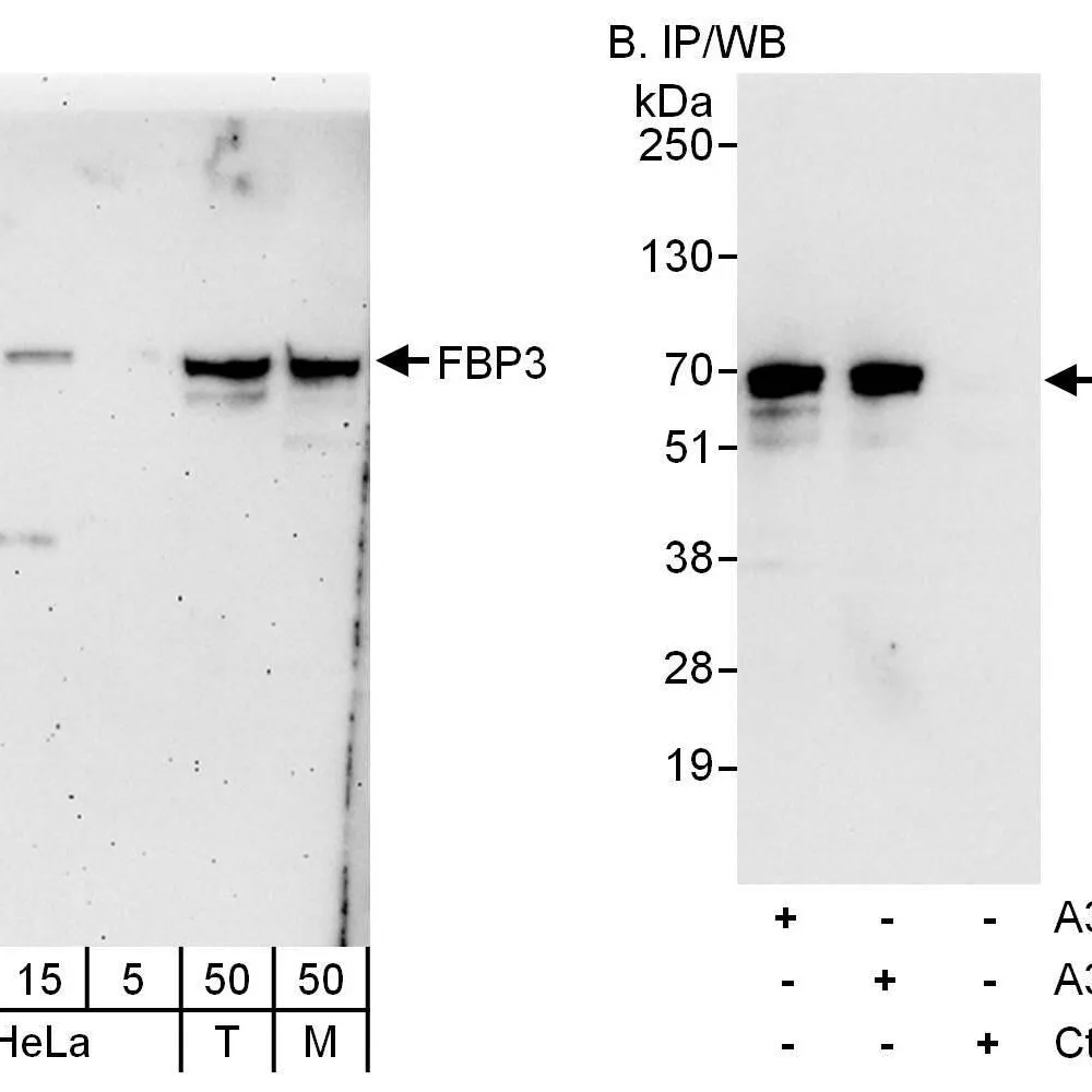 Rabbit anti-FBP3 Antibody, Affinity Purified