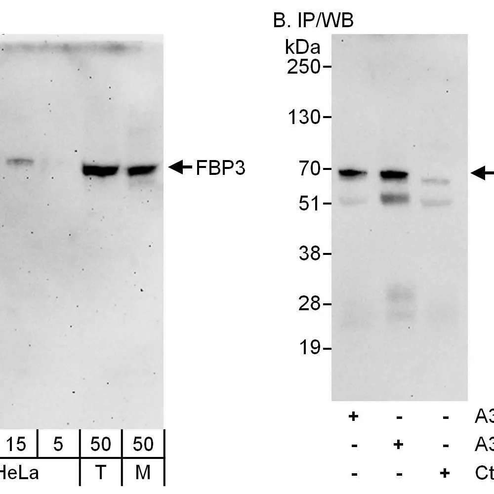 Rabbit anti-FBP3 Antibody, Affinity Purified