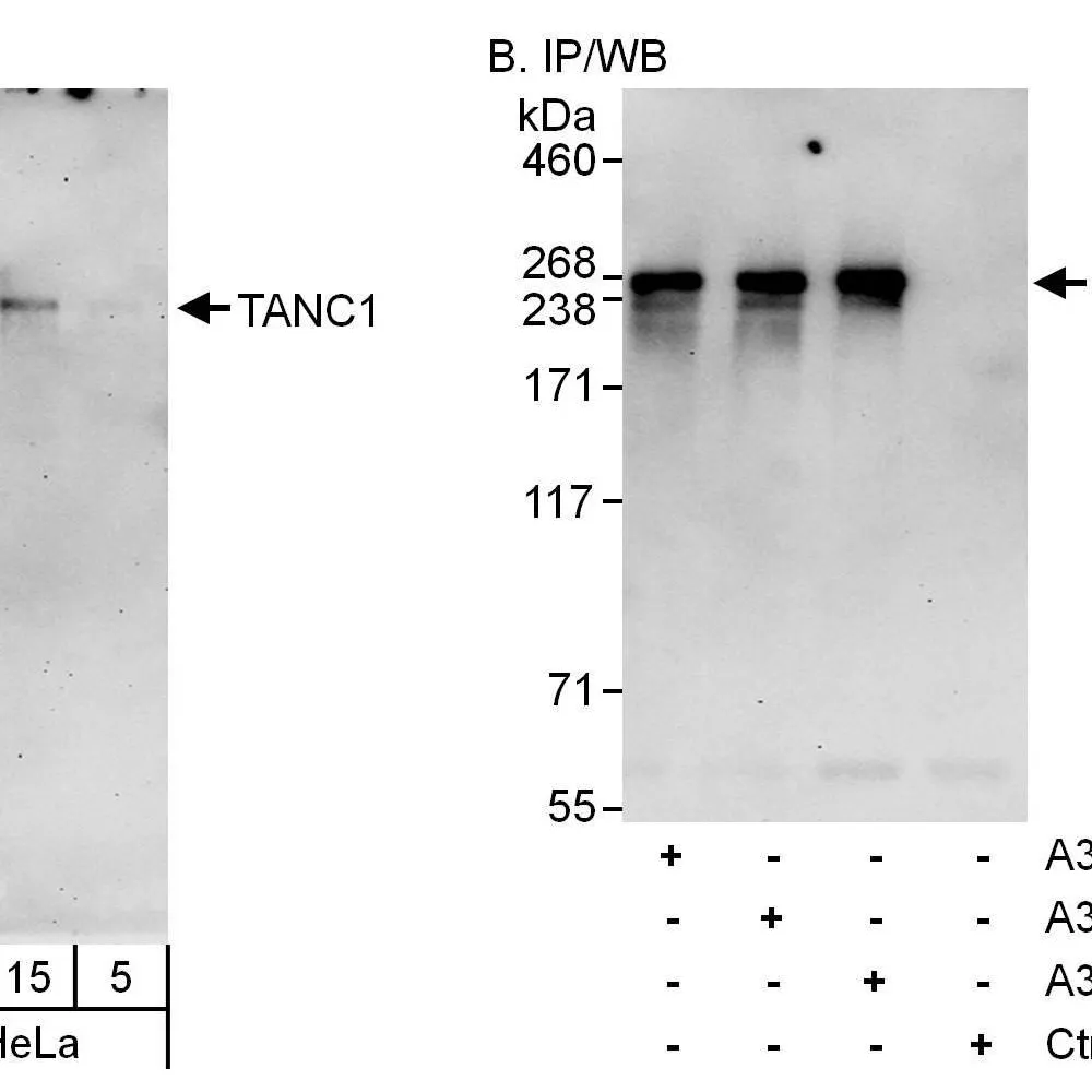 Rabbit anti-TANC1 Antibody, Affinity Purified