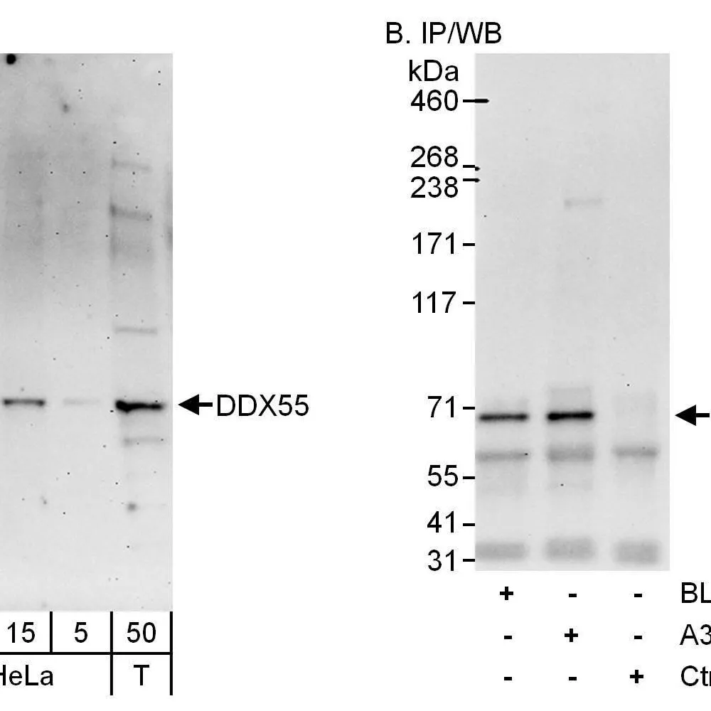 Rabbit anti-DDX55 Antibody, Affinity Purified