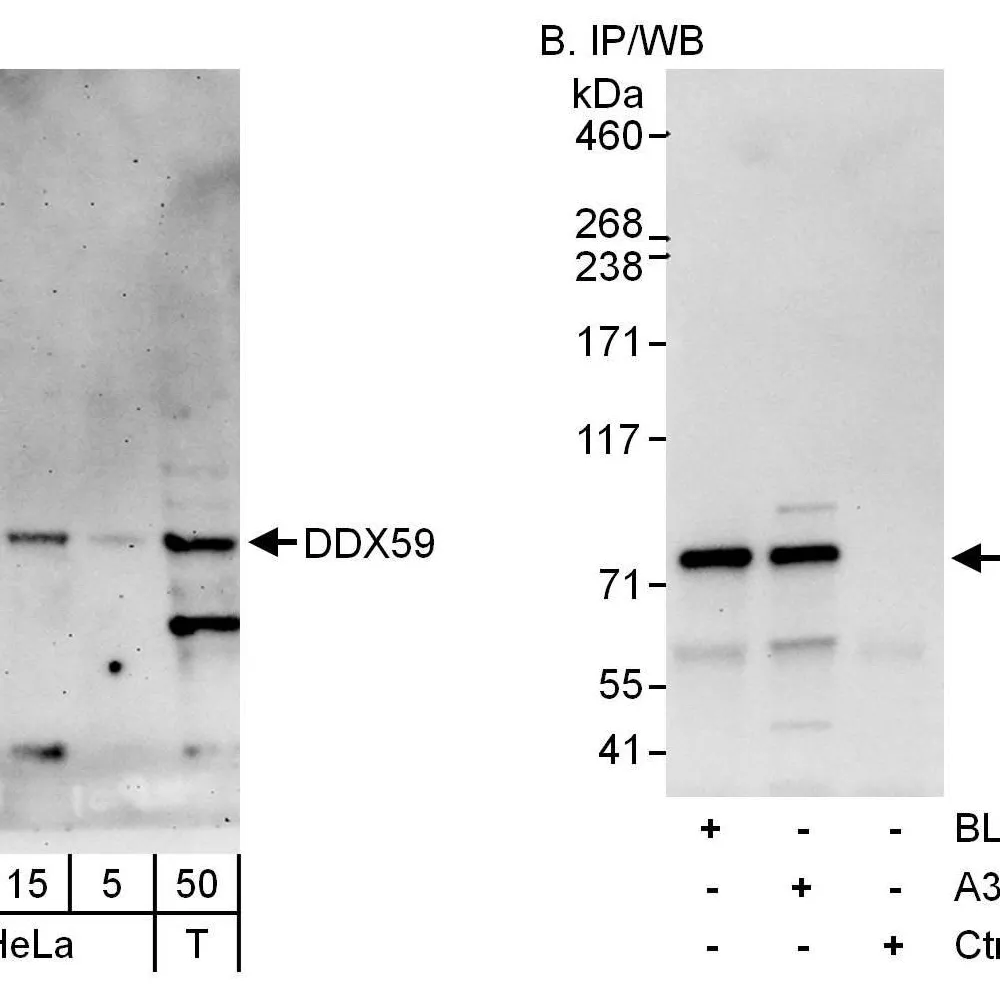 Rabbit anti-DDX59 Antibody, Affinity Purified
