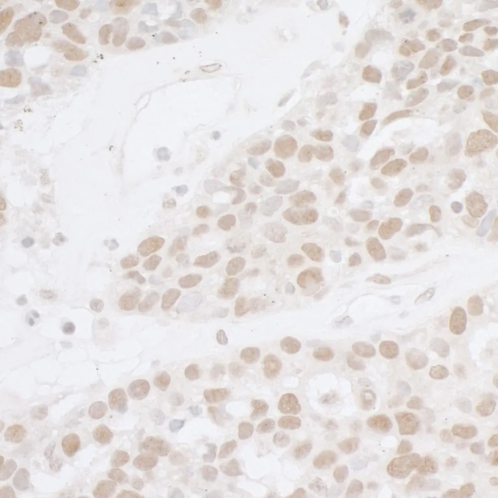 Rabbit anti-ATF1 Antibody, Affinity Purified