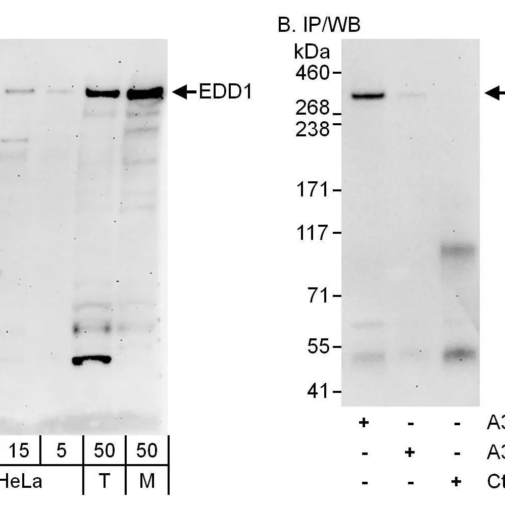 Rabbit anti-EDD1 Antibody, Affinity Purified