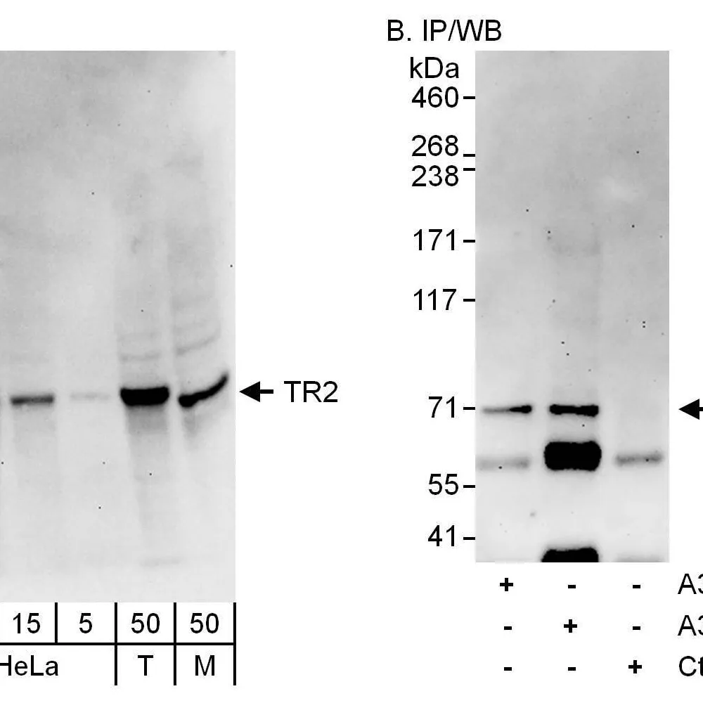 Rabbit anti-TR2 Antibody, Affinity Purified