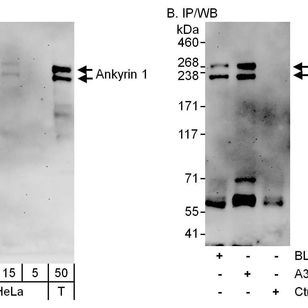 Rabbit anti-Ankyrin 1 Antibody, Affinity Purified
