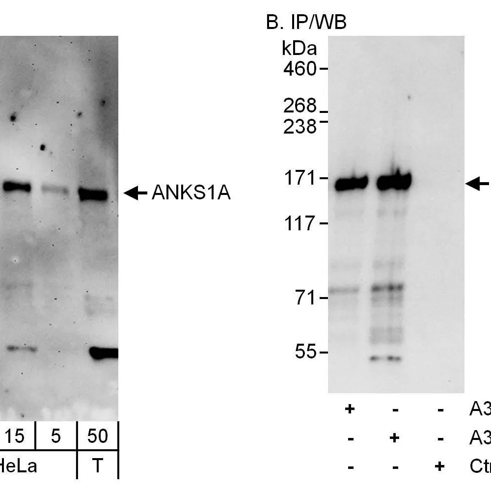 Rabbit anti-ANKS1A Antibody, Affinity Purified