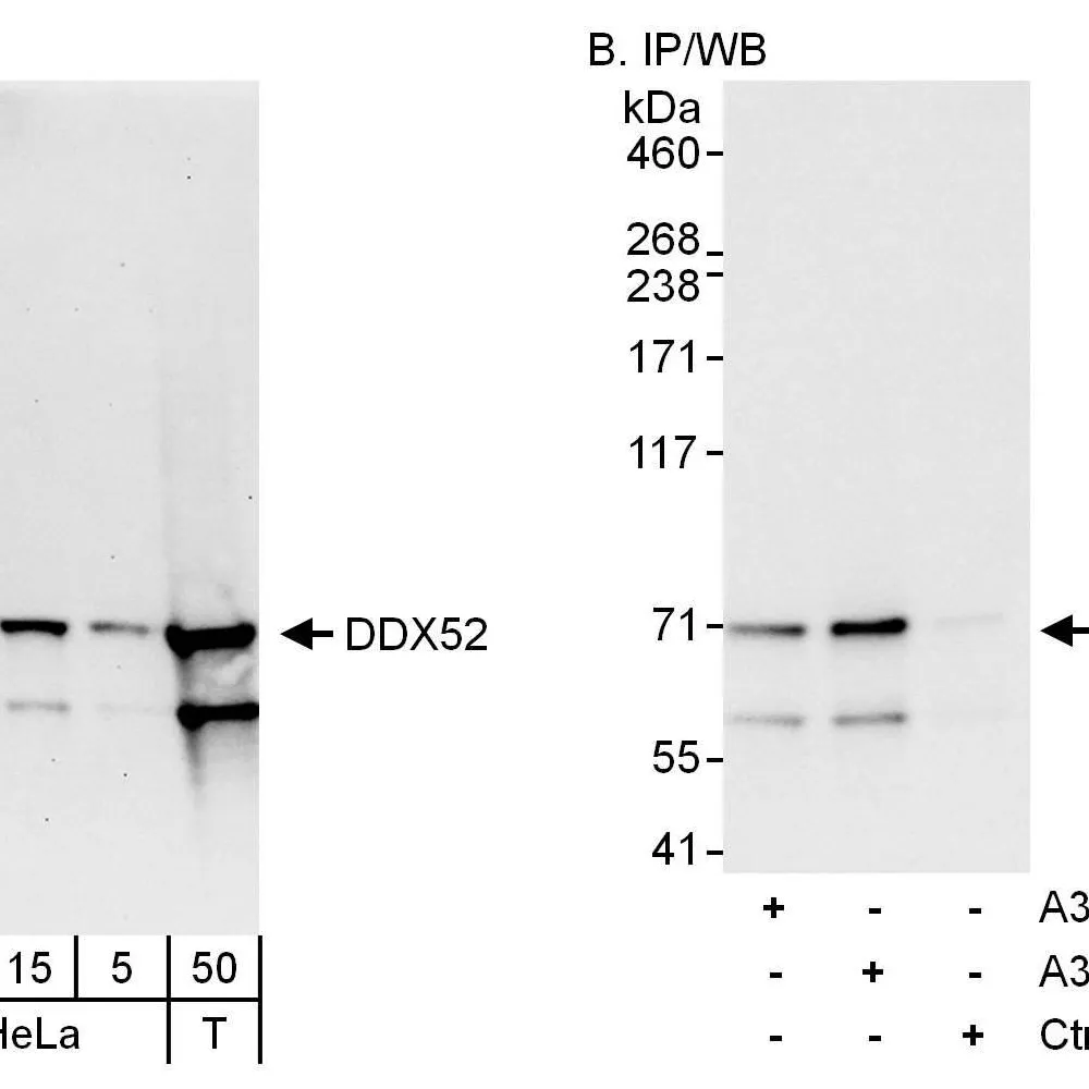 Rabbit anti-DDX52 Antibody, Affinity Purified