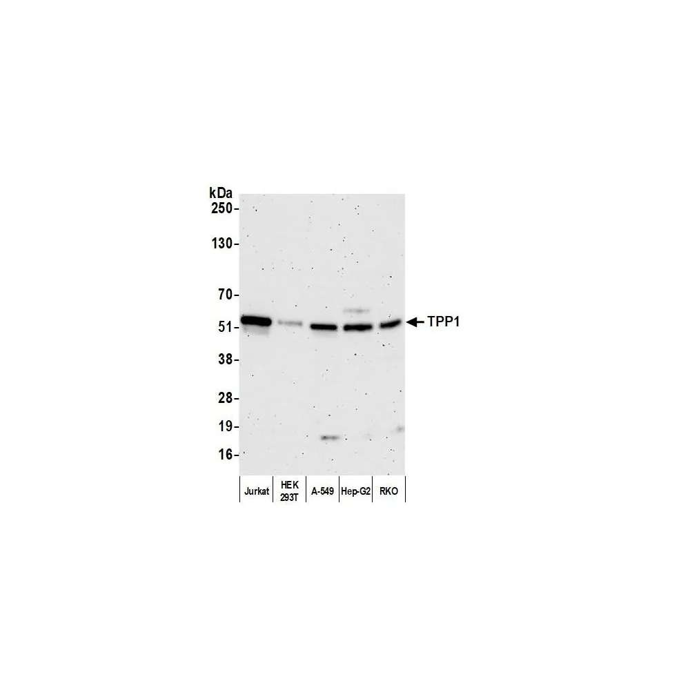 Rabbit anti-TPP1 Antibody, Affinity Purified
