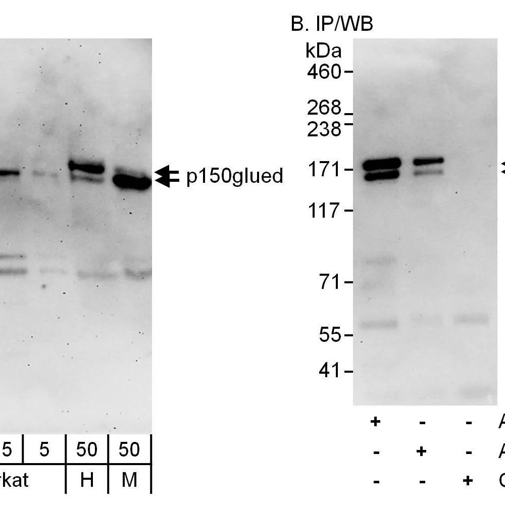 Rabbit anti-p150glued Antibody, Affinity Purified