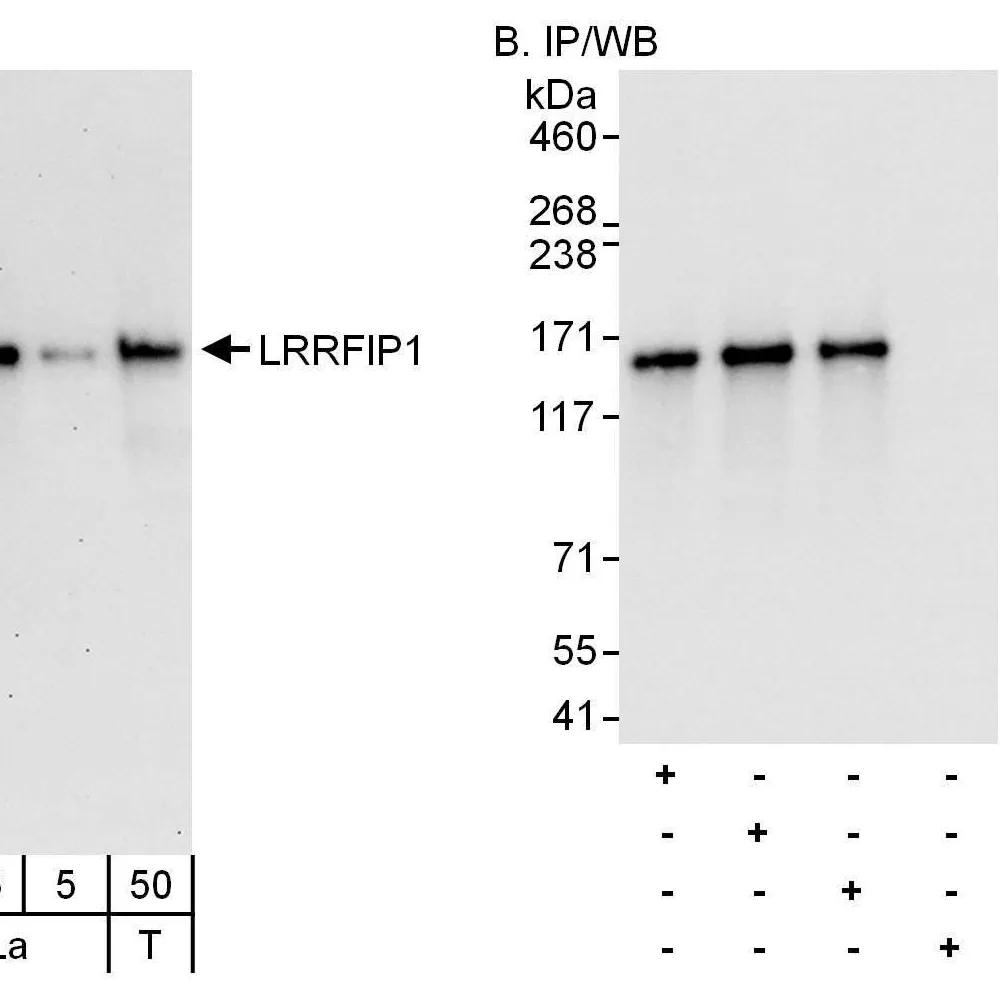 Rabbit anti-LRRFIP1 Antibody, Affinity Purified