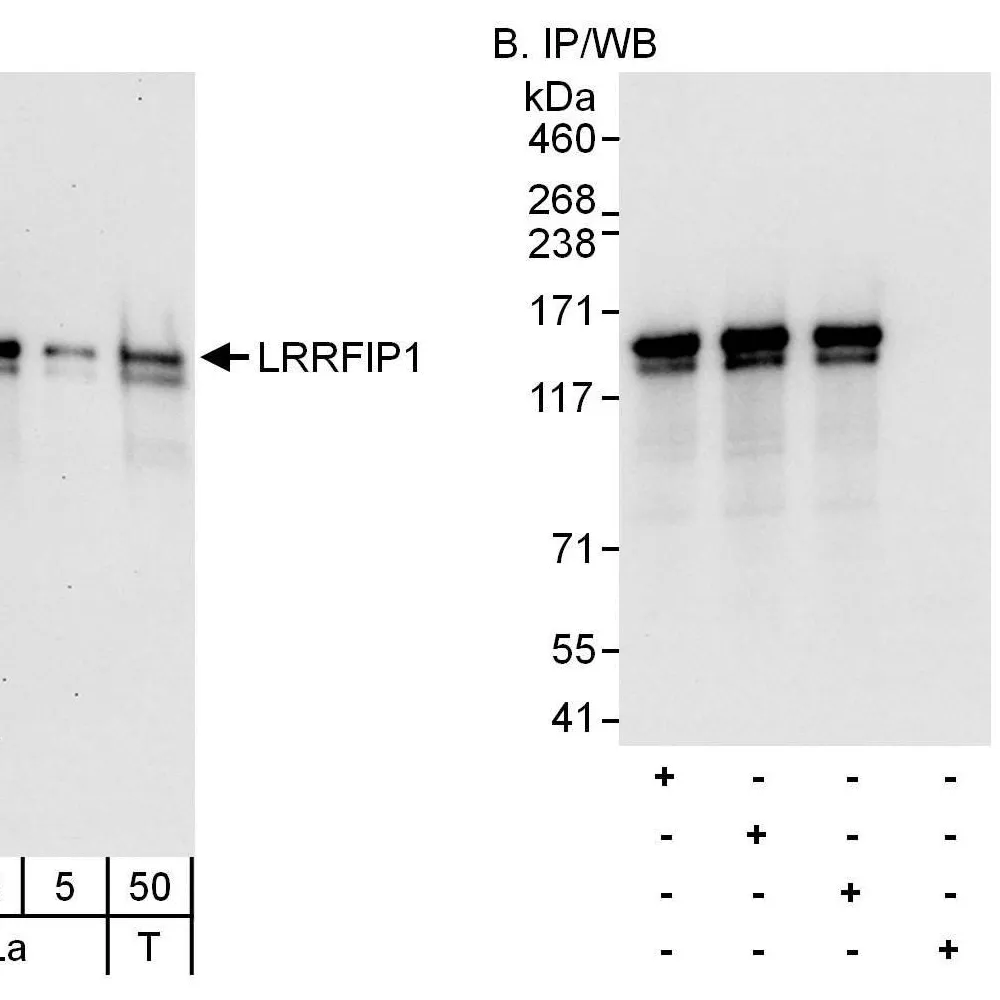 Rabbit anti-LRRFIP1 Antibody, Affinity Purified