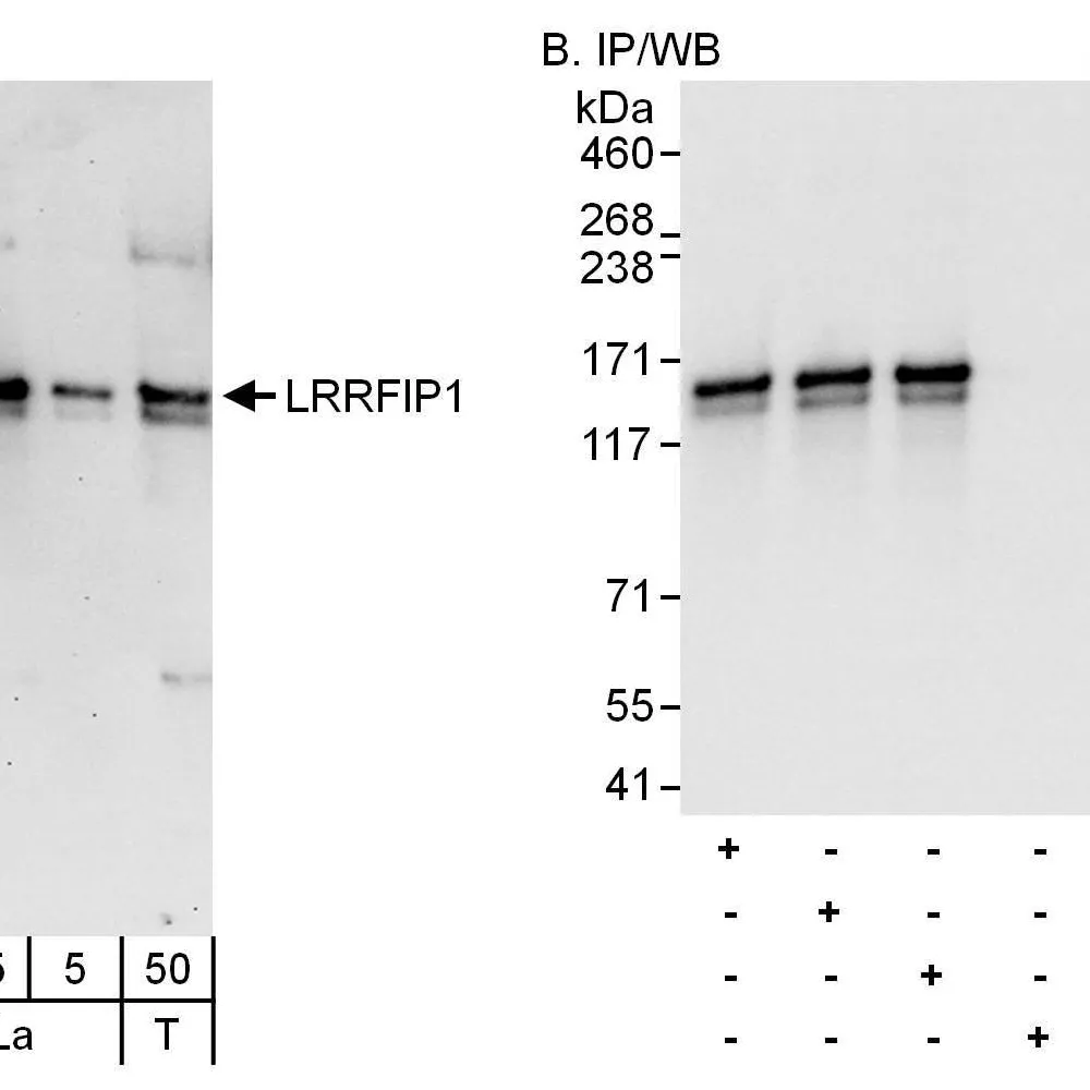 Rabbit anti-LRRFIP1 Antibody, Affinity Purified