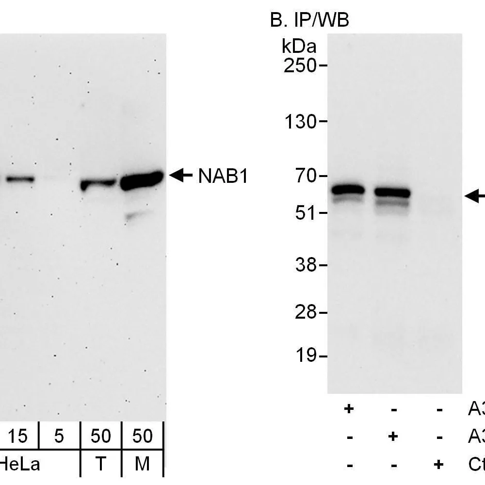 Rabbit anti-NAB1 Antibody, Affinity Purified