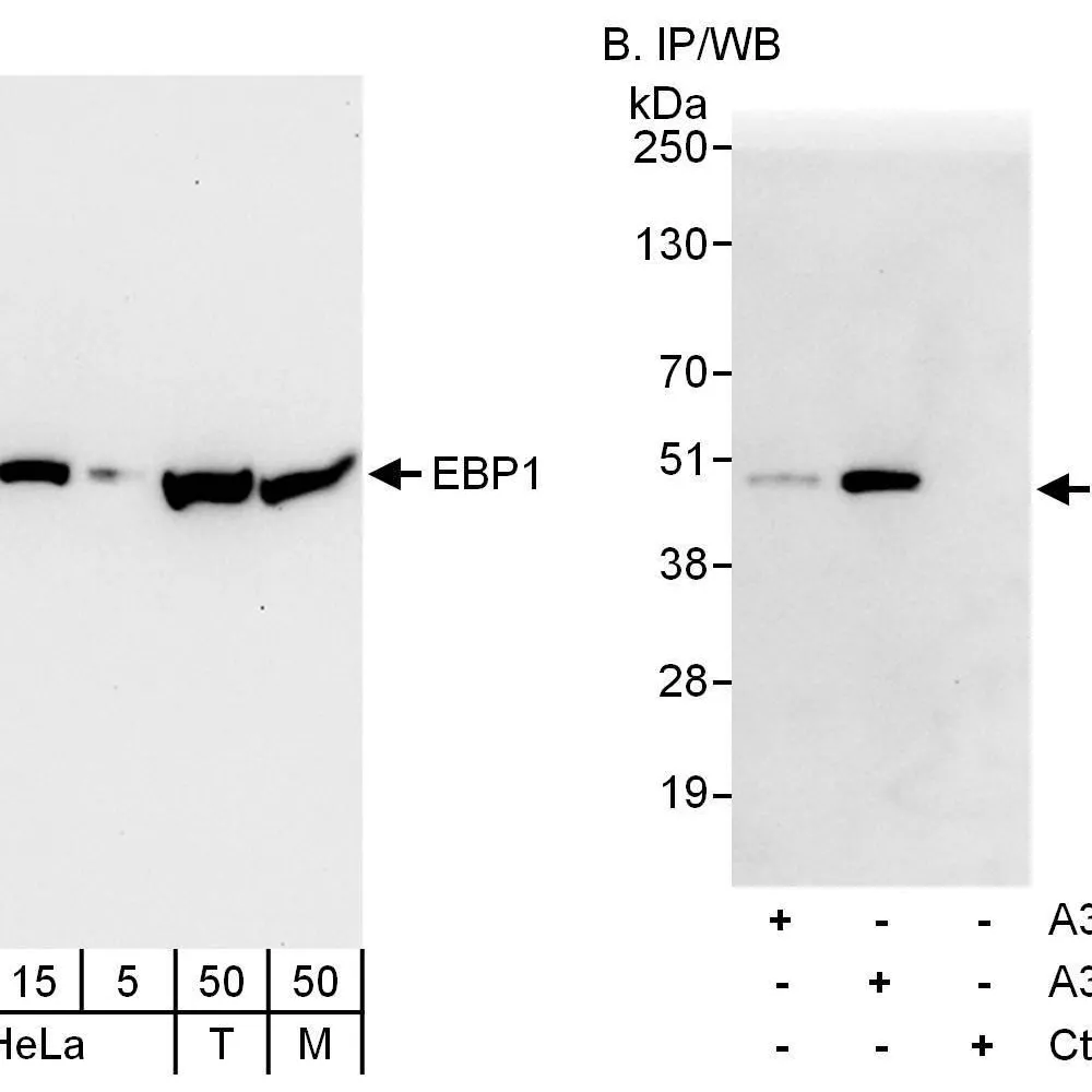Rabbit anti-EBP1 Antibody, Affinity Purified