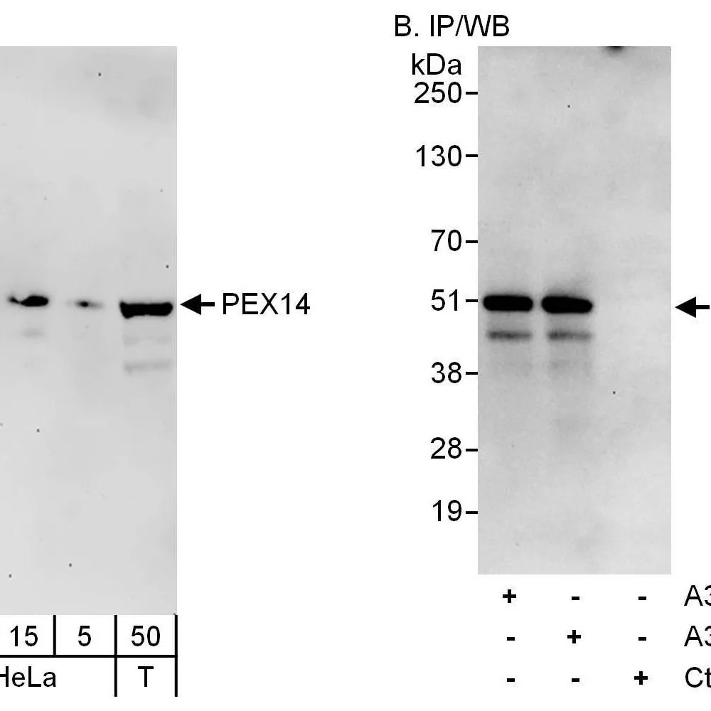 Rabbit anti-PEX14 Antibody, Affinity Purified