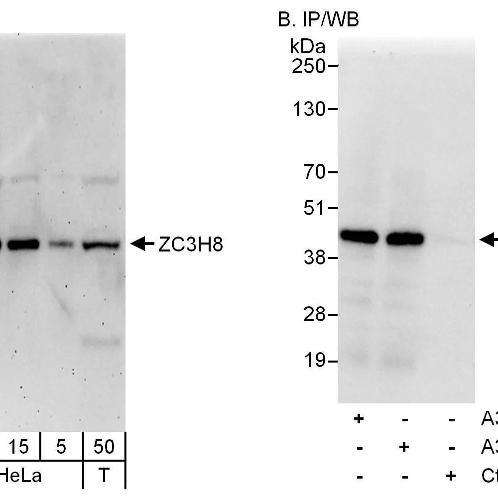 Rabbit anti-ZC3H8 Antibody, Affinity Purified
