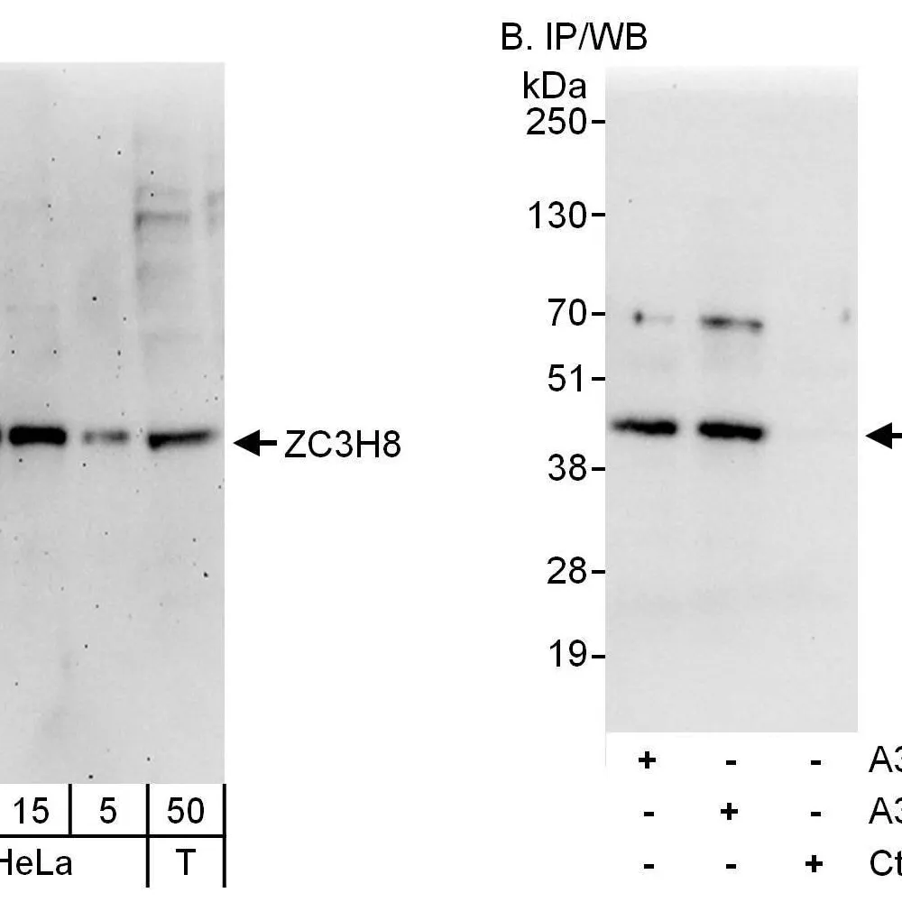 Rabbit anti-ZC3H8 Antibody, Affinity Purified
