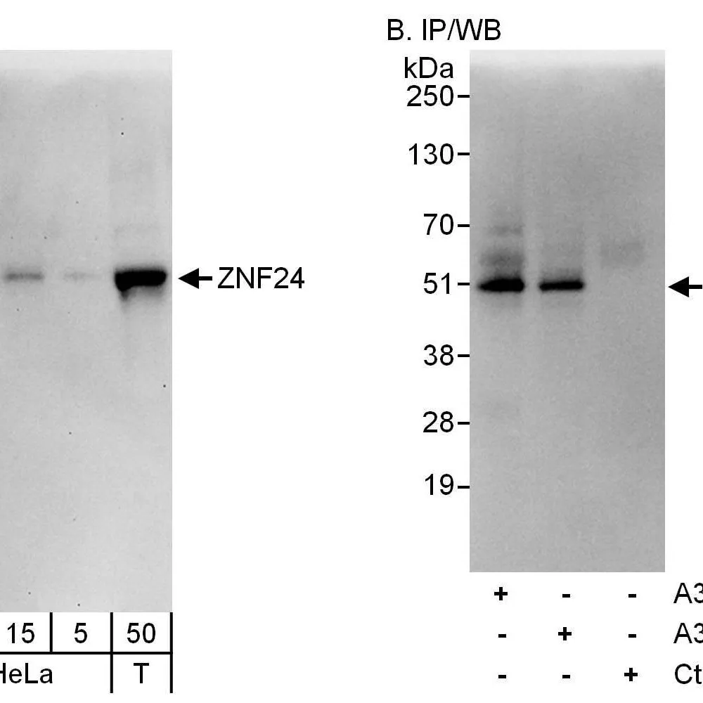 Rabbit anti-ZNF24 Antibody, Affinity Purified