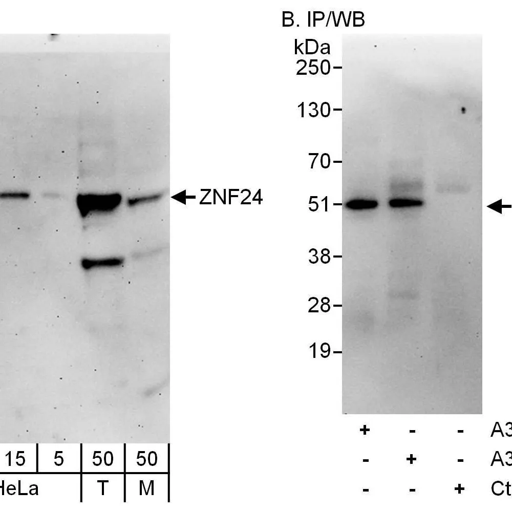 Rabbit anti-ZNF24 Antibody, Affinity Purified