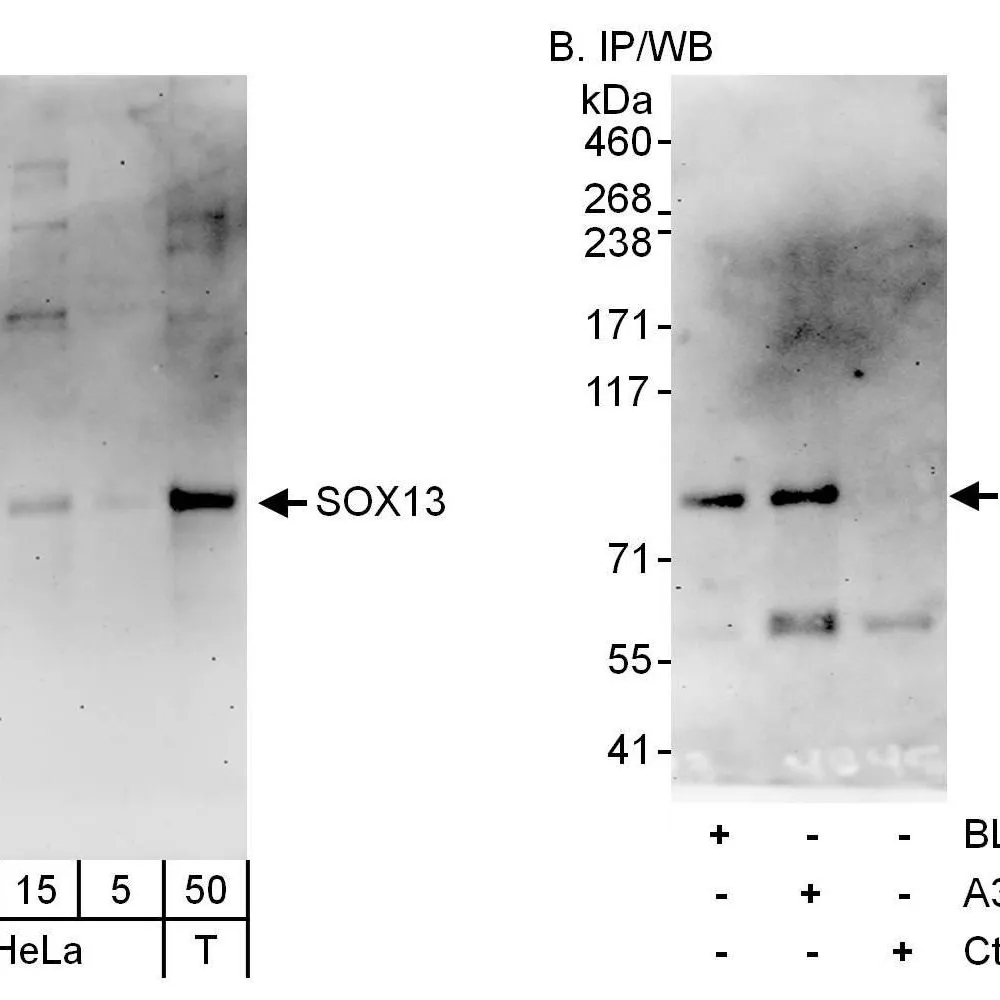 Rabbit anti-SOX13 Antibody, Affinity Purified