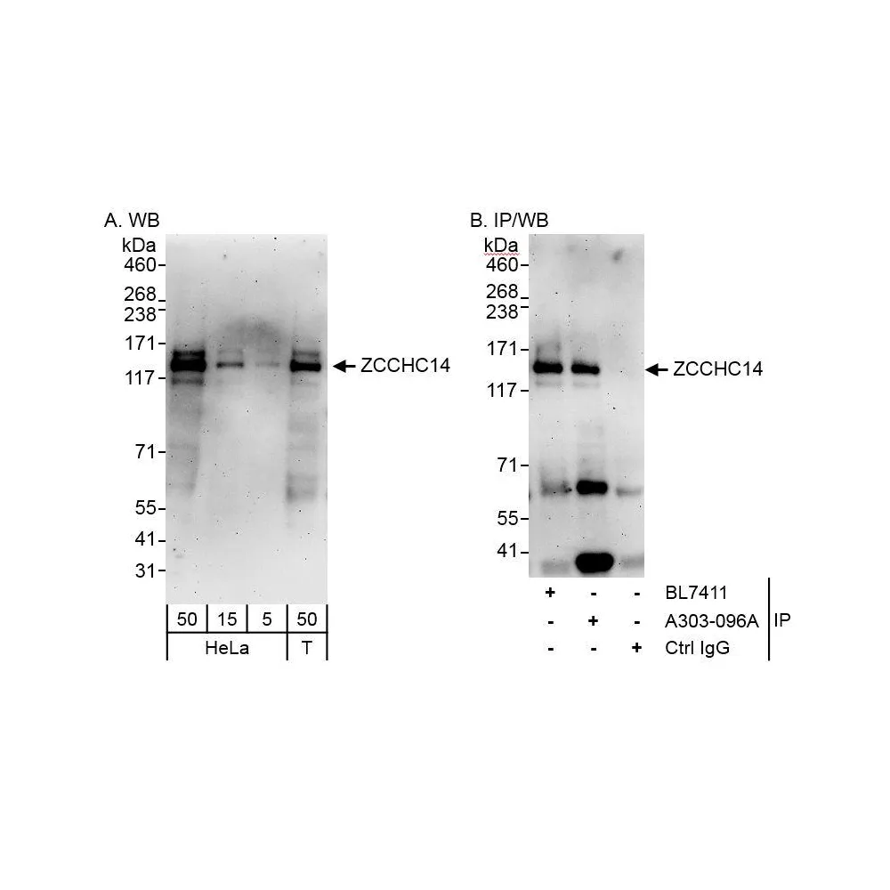 Rabbit anti-ZCCHC14 Antibody, Affinity Purified