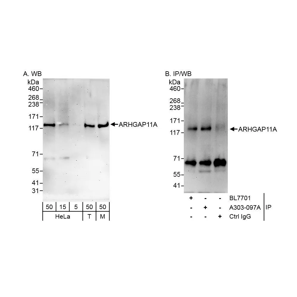 Rabbit anti-ARHGAP11A Antibody, Affinity Purified