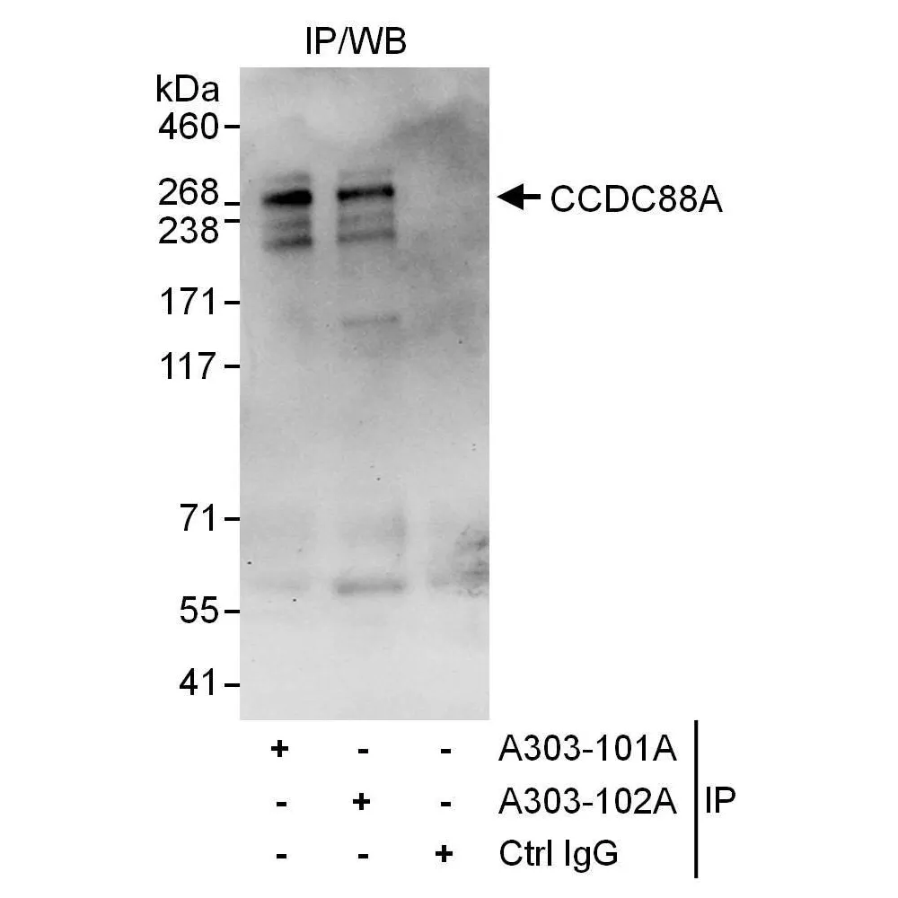 Rabbit anti-CCDC88A Antibody, Affinity Purified