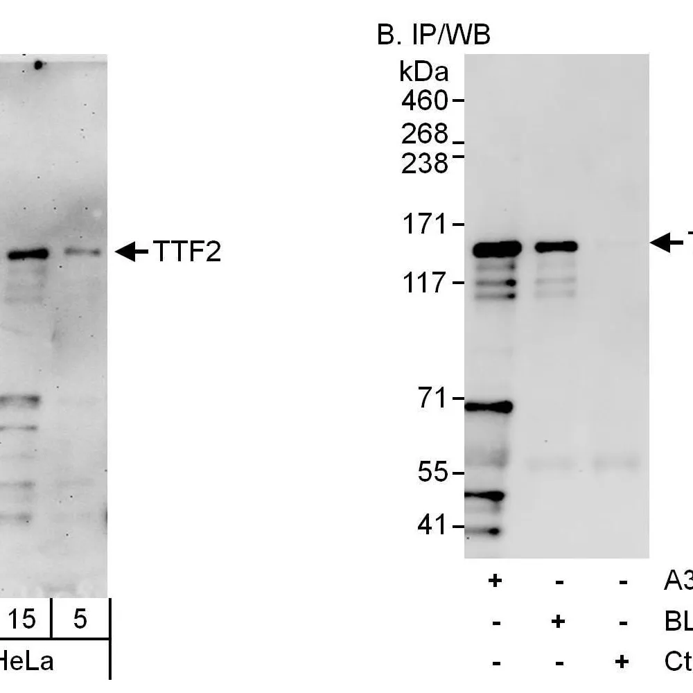 Rabbit anti-TTF2 Antibody, Affinity Purified