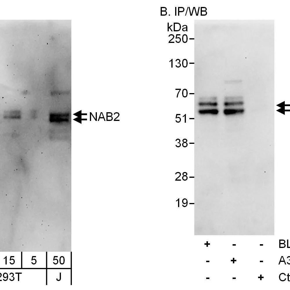 Rabbit anti-NAB2 Antibody, Affinity Purified