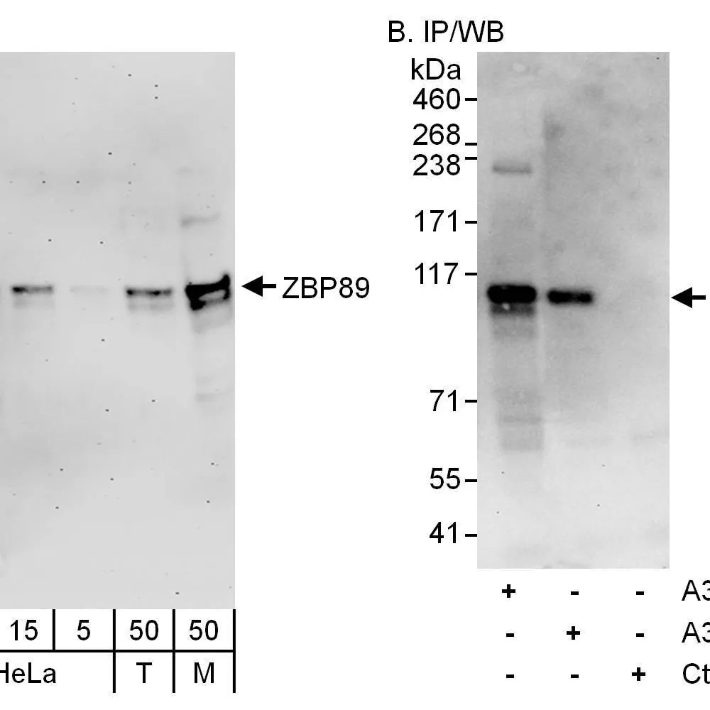 Rabbit anti-ZBP89 Antibody, Affinity Purified