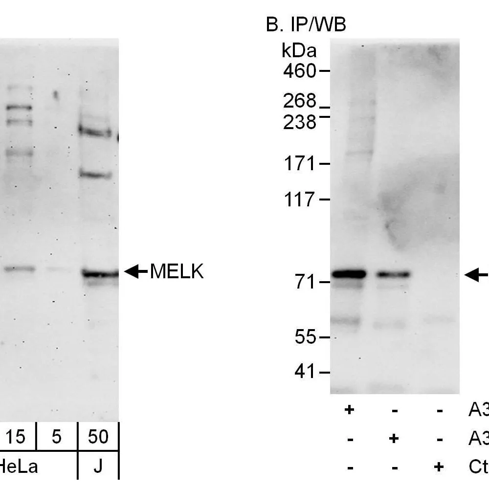 Rabbit anti-MELK Antibody, Affinity Purified