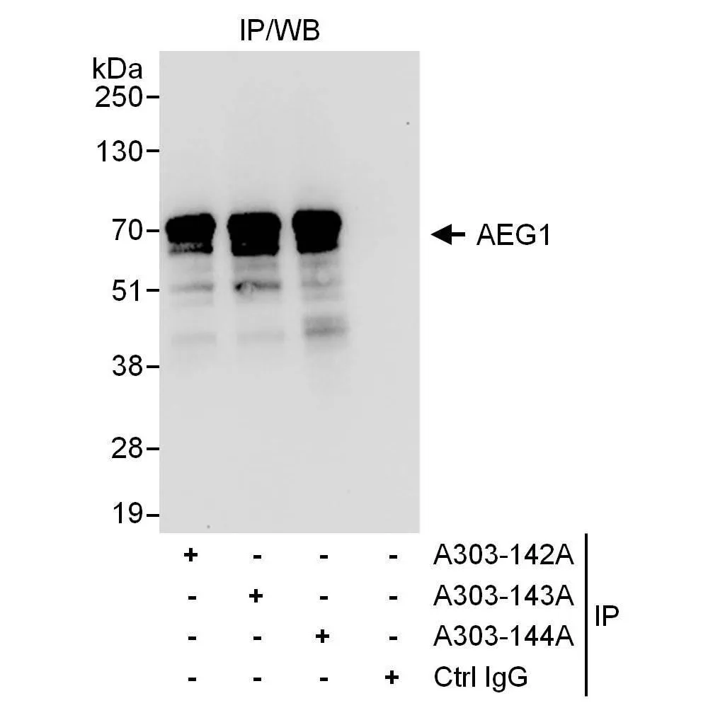 Rabbit anti-AEG1 Antibody, Affinity Purified