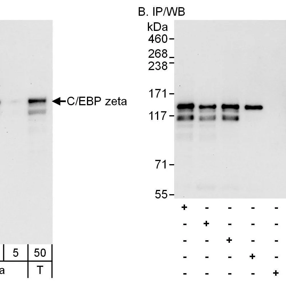 Rabbit anti-C/EBP zeta Antibody, Affinity Purified