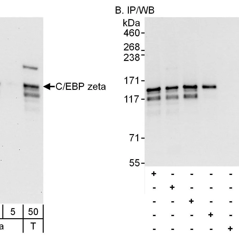 Rabbit anti-C/EBP zeta Antibody, Affinity Purified