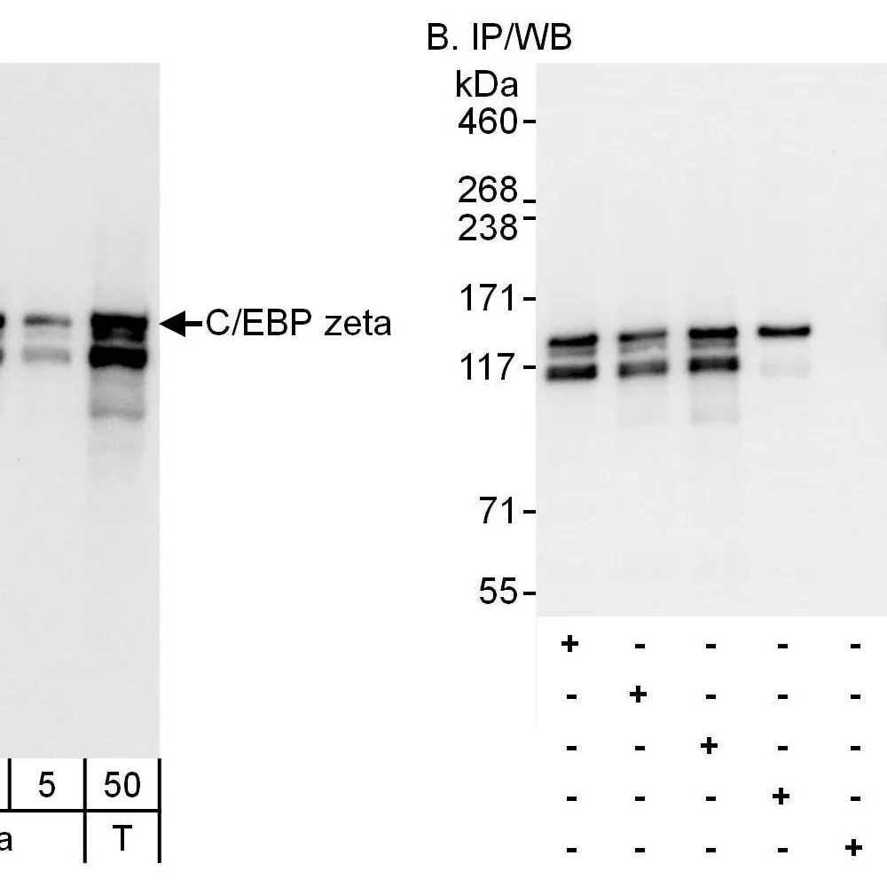 Rabbit anti-C/EBP zeta Antibody, Affinity Purified