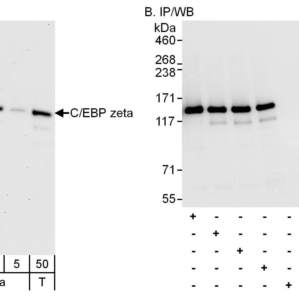 Rabbit anti-C/EBP zeta Antibody, Affinity Purified