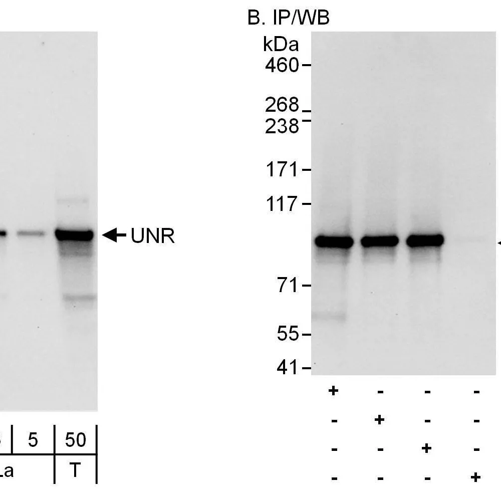 Rabbit anti-UNR Antibody, Affinity Purified