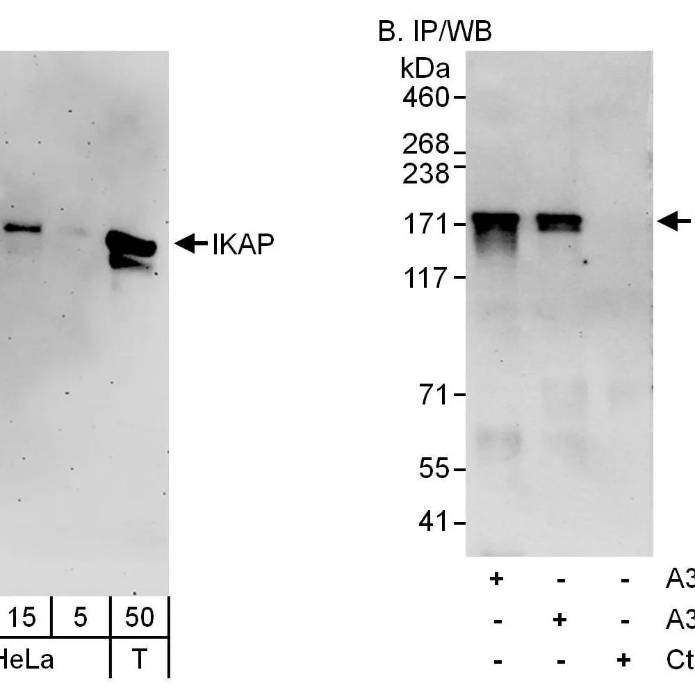 Rabbit anti-IKAP Antibody, Affinity Purified