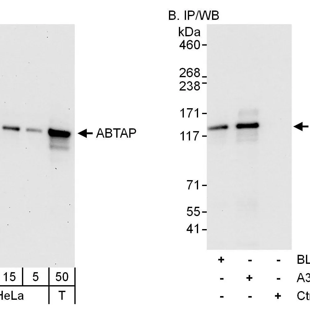 Rabbit anti-ABTAP Antibody, Affinity Purified