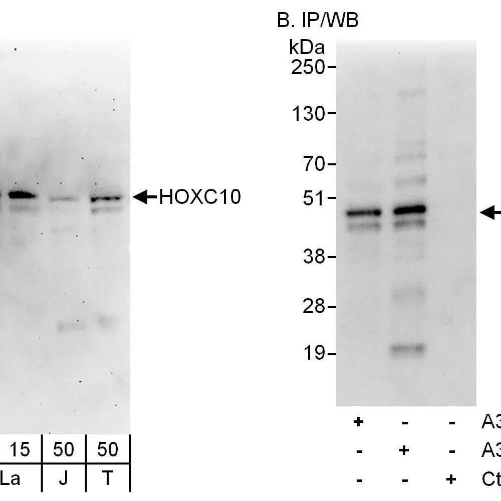 Rabbit anti-HOXC10 Antibody, Affinity Purified