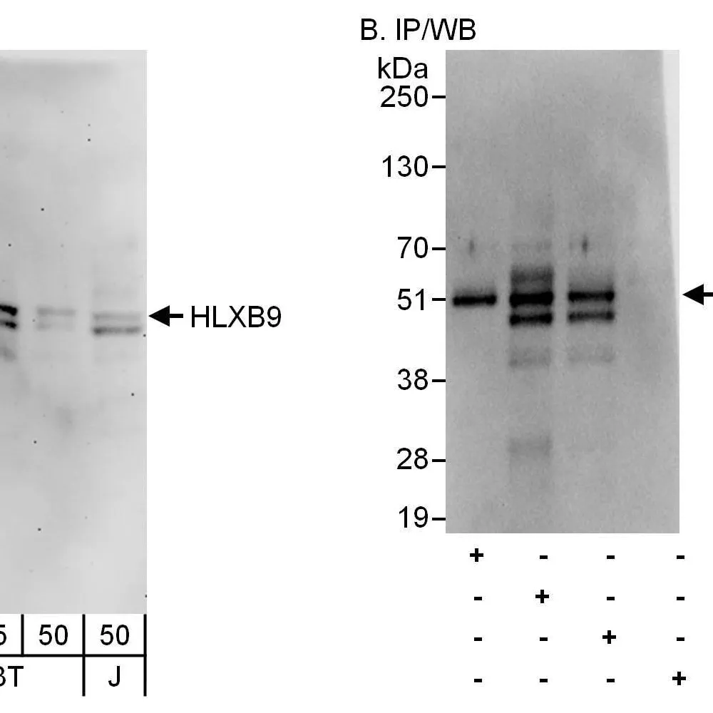 Rabbit anti-HLXB9 Antibody, Affinity Purified