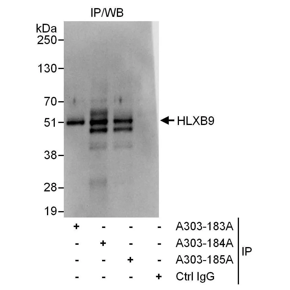 Rabbit anti-HLXB9 Antibody, Affinity Purified